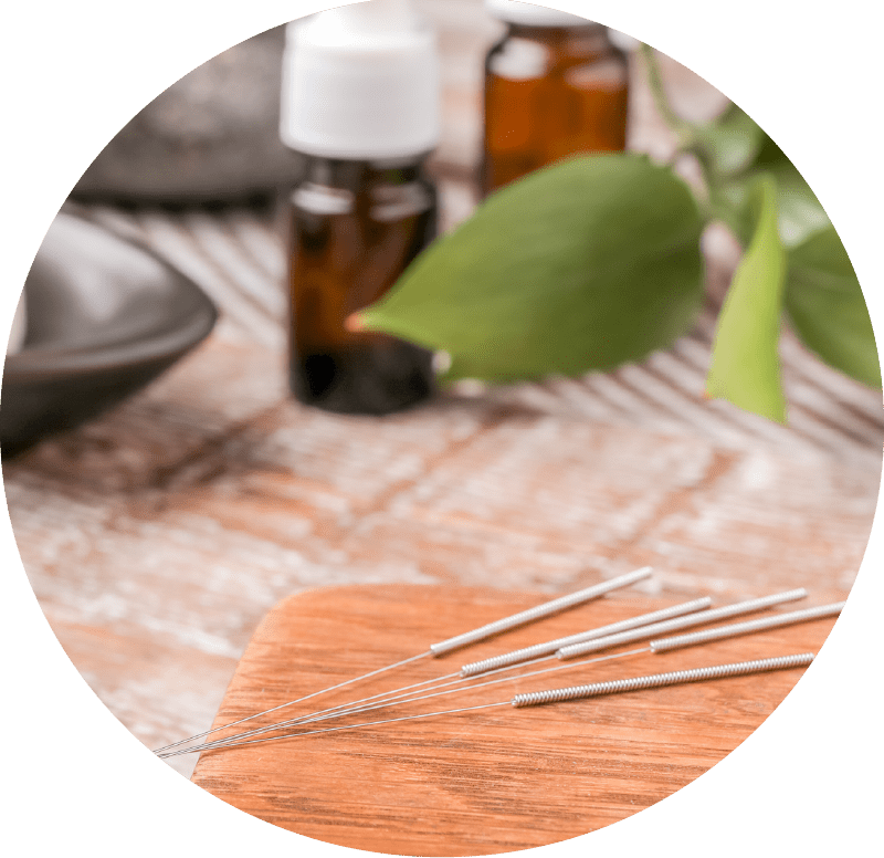 Akupunktur in Wiesbaden-Biebrich